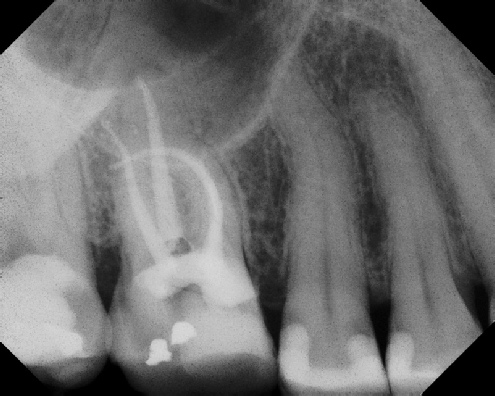 Root Canal Anatomy - Stratford