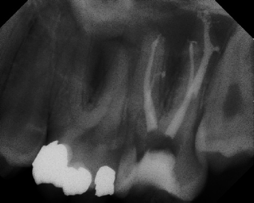 Root Canal Anatomy - Stratford