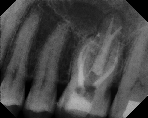 Root Canal Anatomy - Stratford