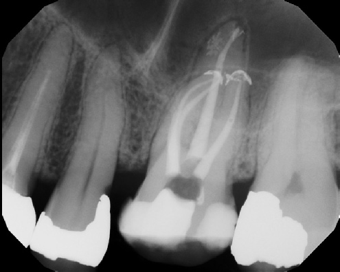 Root Canal Anatomy - Stratford