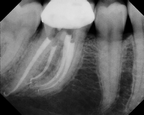 root canal anatomy - Meriden