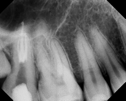 Root Canal Anatomy - Meriden