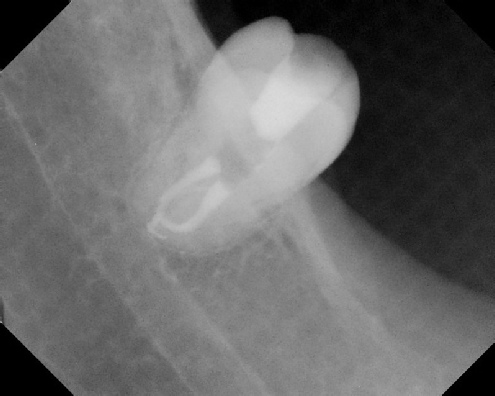 Root Canal Anatomy - Stratford