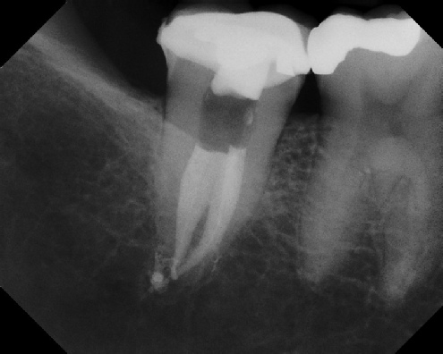 Root Canal Anatomy - Stratford