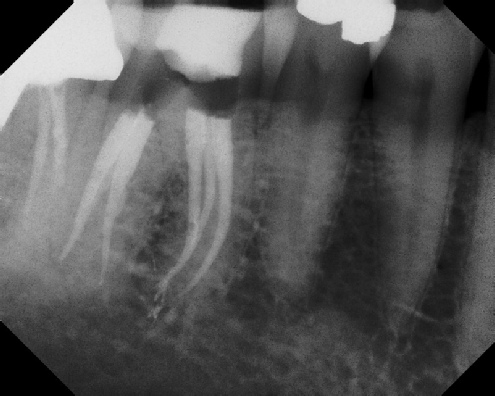 Root Canal Anatomy - Stratford