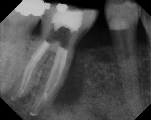 Root Canal Anatomy - Meriden