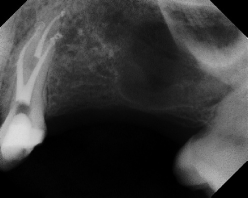 Root Canal Anatomy - Meriden