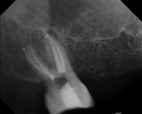 Root Canal Anatomy - Stratford