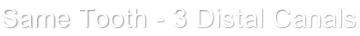 Same Tooth - 3 Distal Canals