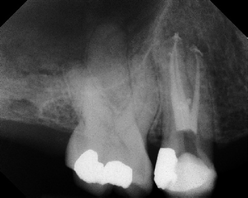 Root Canal Anatomy - Meriden