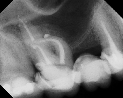 Root Canal Anatomy - Stratford