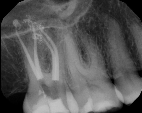 Root Canal Anatomy - Stratford